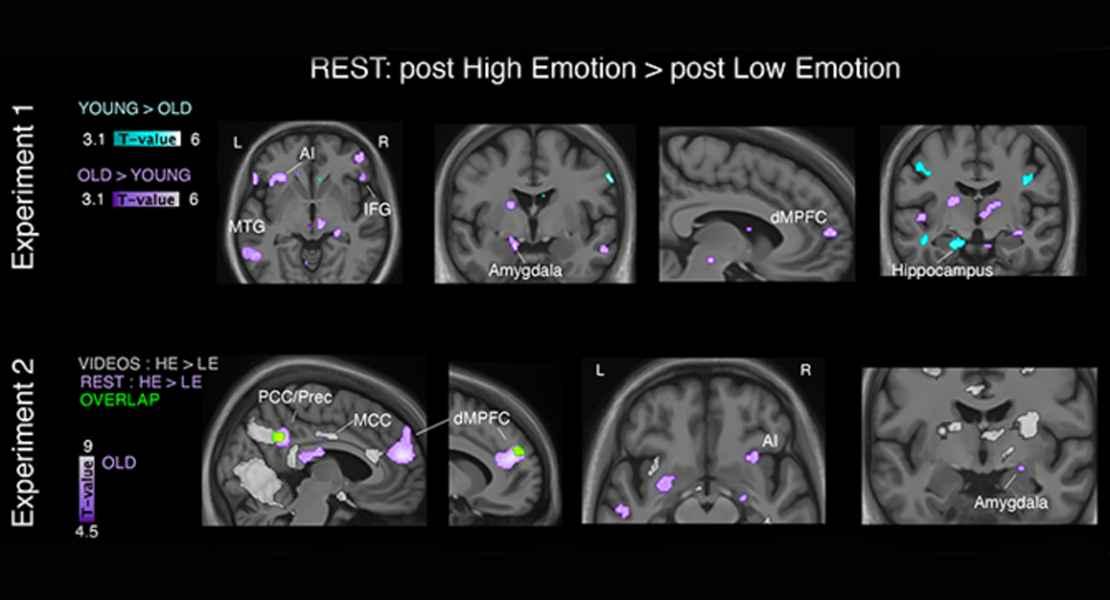 I neurologi ritengono che le emozioni negative, l'ansia e la depressione favoriscano l'insorgenza di malattie neurodegenerative e demenza