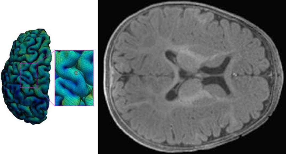 Nuova mappa della corteccia cerebrale in via di sviluppo