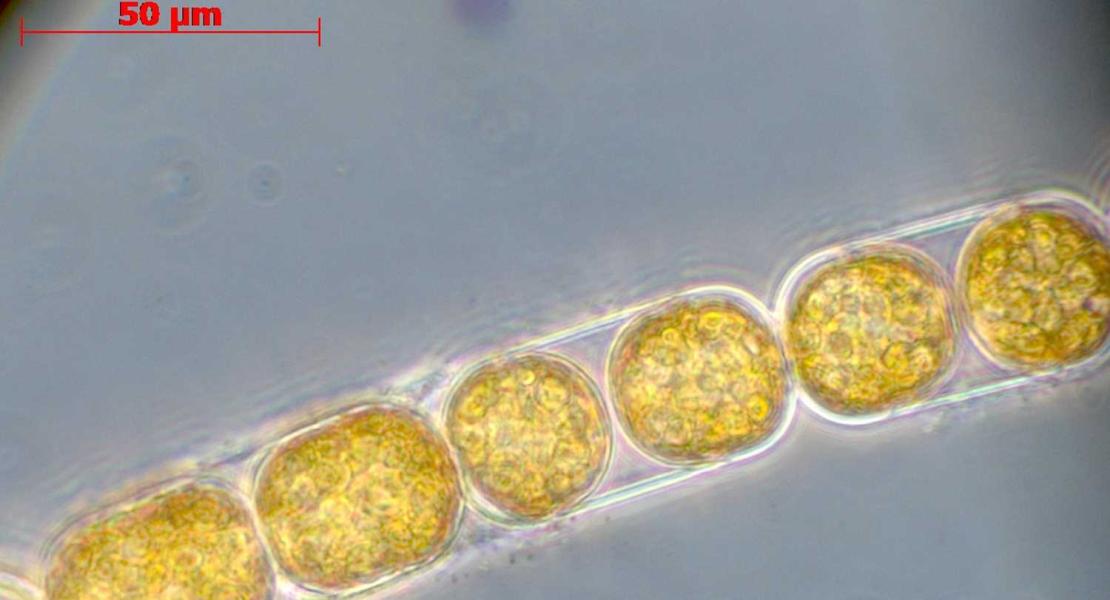 Al microscopio ottico diventano visibili le lunghe catene delle alghe unicellulari. Le alghe appaiono di colore arancione-marrone a causa del loro tipico pigmento fucoxantina, che consente loro di fotosintetizzare anche in condizioni di scarsa illuminazione. (Foto: Madlen Franze)