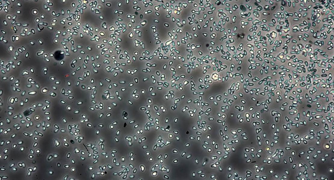 Spore del parassita delle pulci d'acqua Ordospora colligata