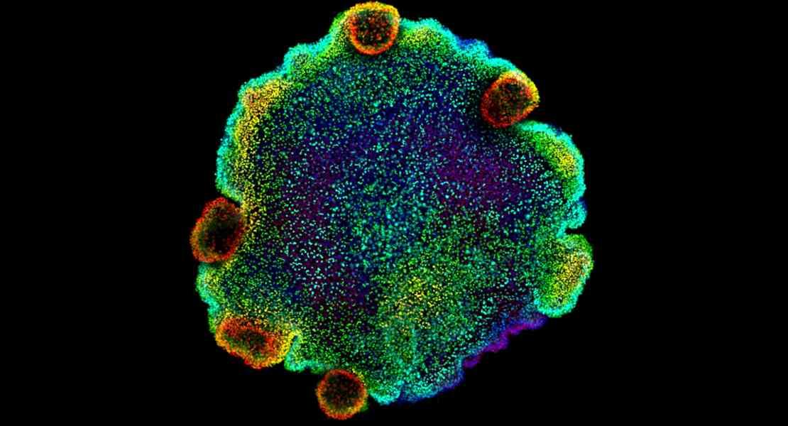 Trichoplax sp. H2
