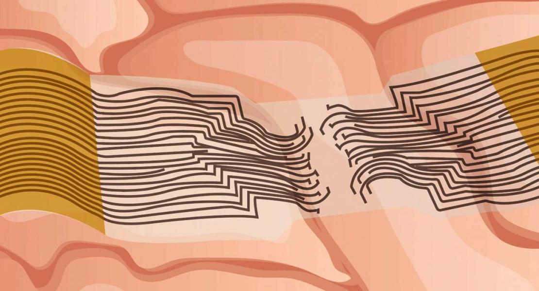 Elettrodi neurali per stimolare il cervello
