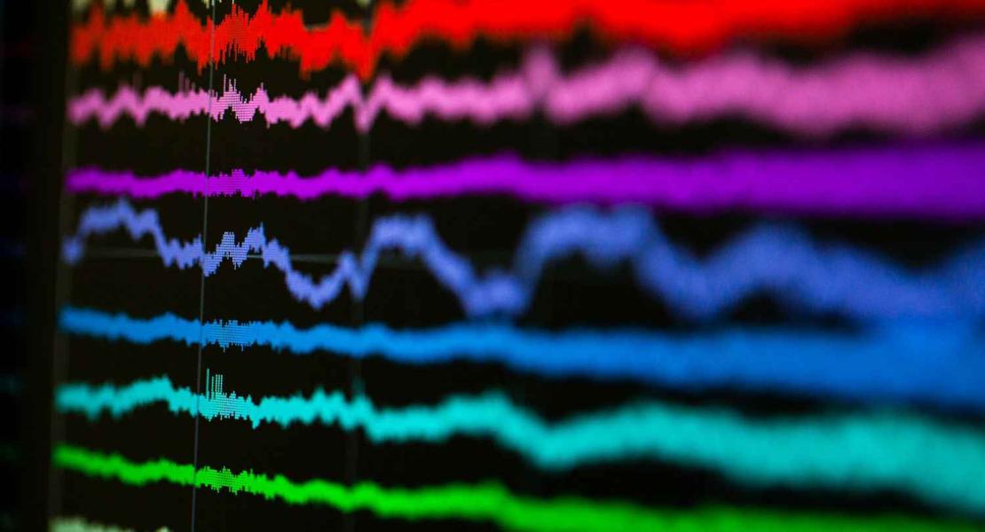 Raffigurazione di come i neuroni si attivano
