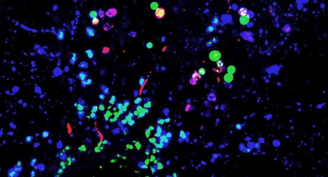 Nanoparticelle di plastica