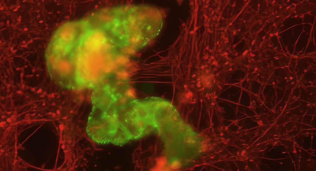 Un aggregato di Anthrobot, o superbot (verde), stimola la crescita dei neuroni (rossi) dove erano stati meccanicamente strappati via.