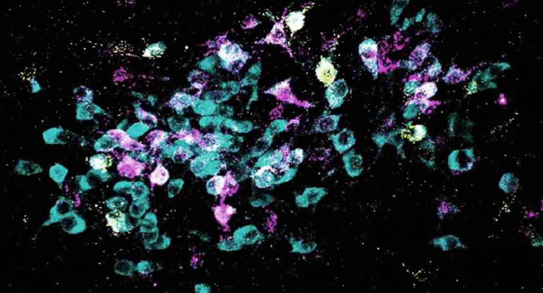 I neuroni sono mostrati in ciano e i traccianti retrogradi sono mostrati in giallo e magenta.