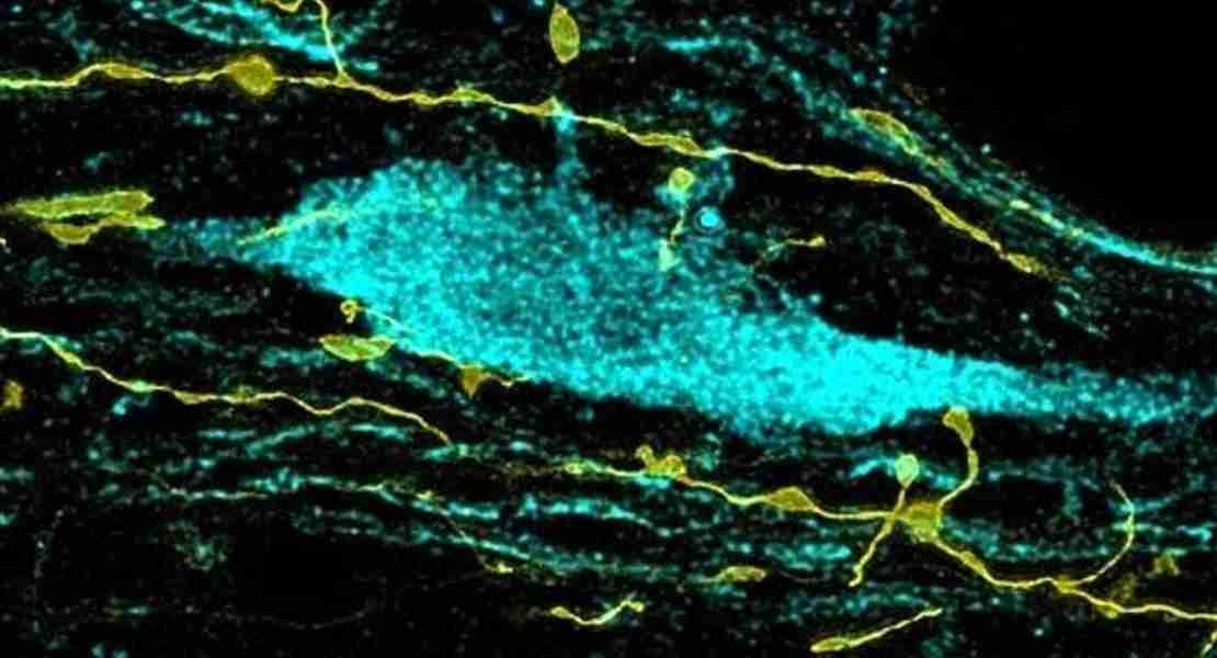 Gli assoni contattano un neurone colinergico