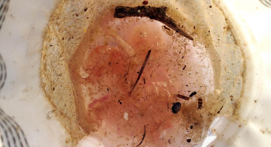 Zooplancton, particelle naturali e microplastiche di varie dimensioni.