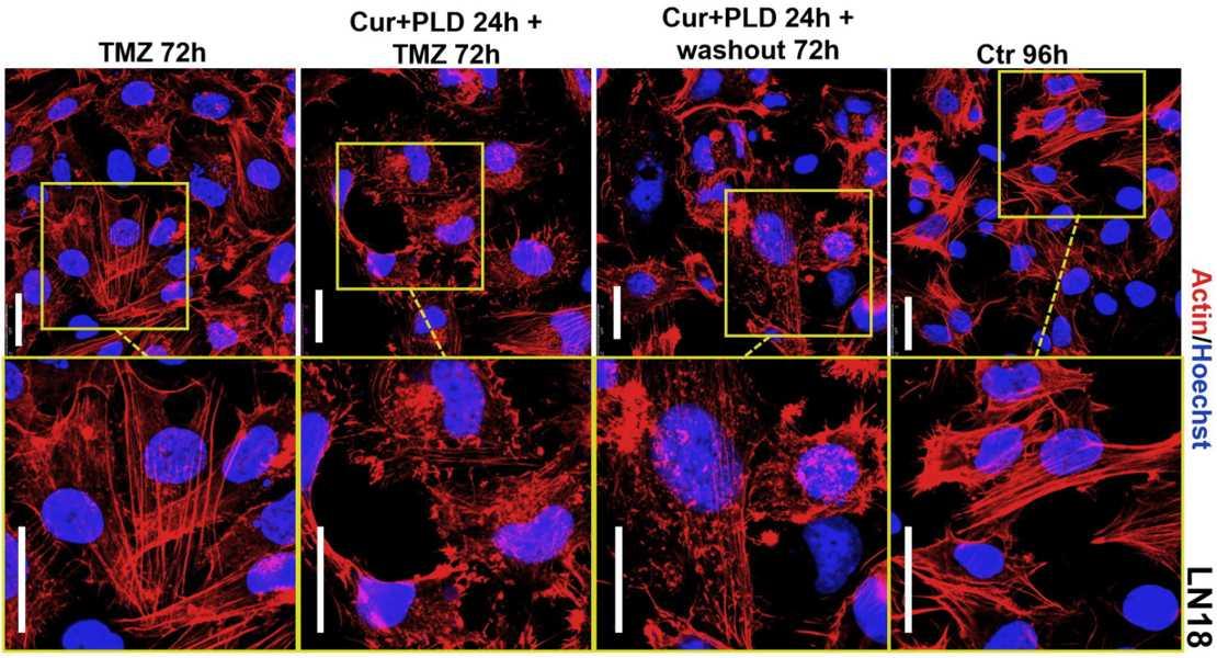 Effetti in presenza o meno del pretrattamento con curcumina e polidatina sulle cellule tumorali di glioblastioma trattate con temozolomide.