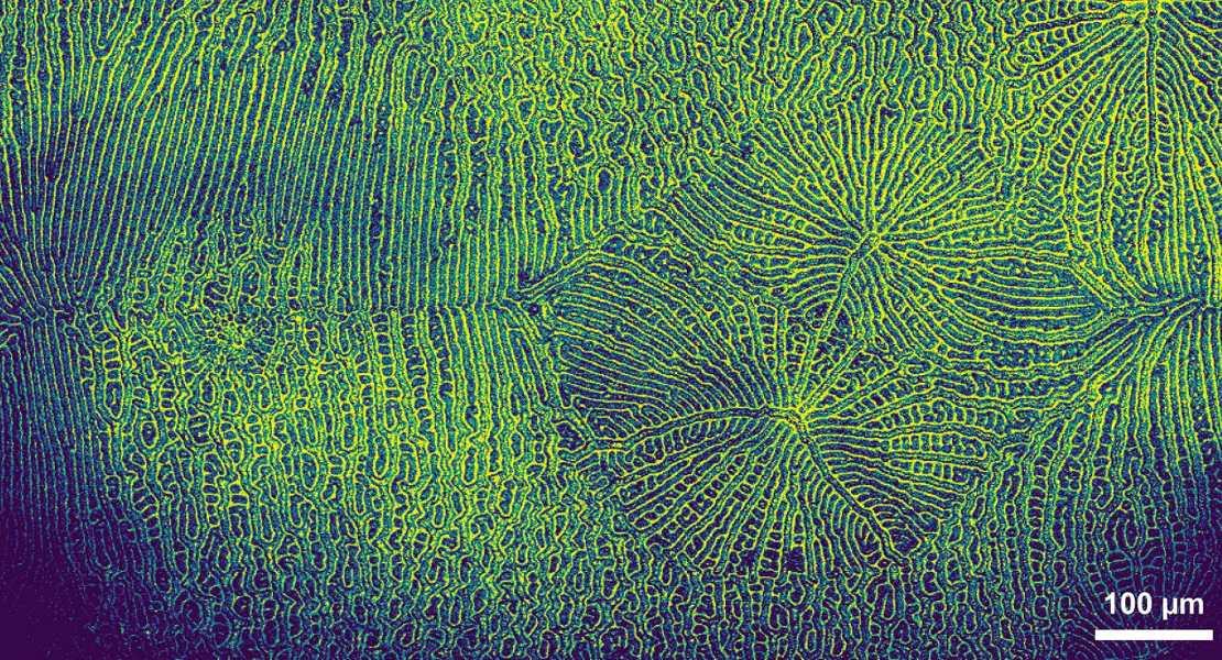 Microscopia confocale