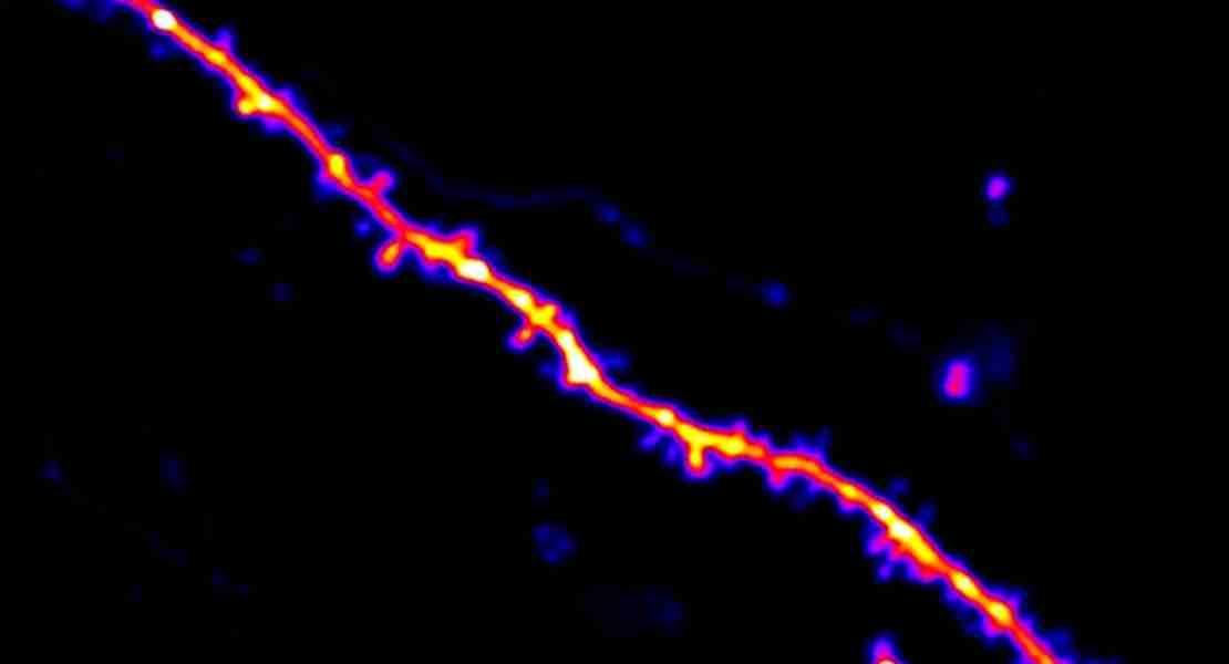 Mentre i topi hanno appreso un nuovo comportamento, i ricercatori hanno rintracciato strettamente le connessioni sinaptiche (rappresentate qui come piccole sporgenze) sui dendriti dei neuroni.