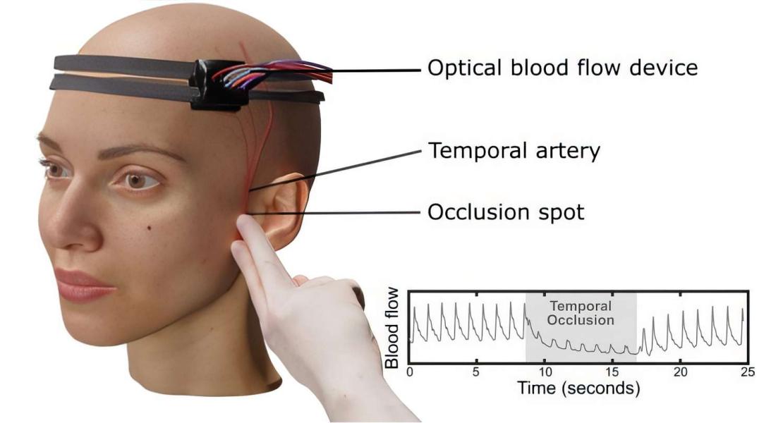 Sistema di spettroscopia ottica