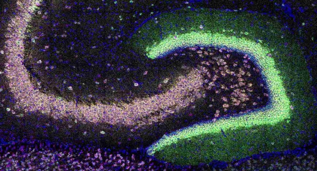 Quattro mRNA localizzati nel neuropilo, la fitta rete di connessioni sinaptiche in uno strato distinto dai corpi cellulari, nell’ippocampo giovanile del topo. Gli mRNA sono stati etichettati utilizzando il test di ibridazione in situ HiPlex RNAscope per rilevare Adcy1 (verde), Aco2 (magenta), Psd (ciano) e Dlg4 (giallo) e i nuclei sono stati controcolorati con DAPI (blu).