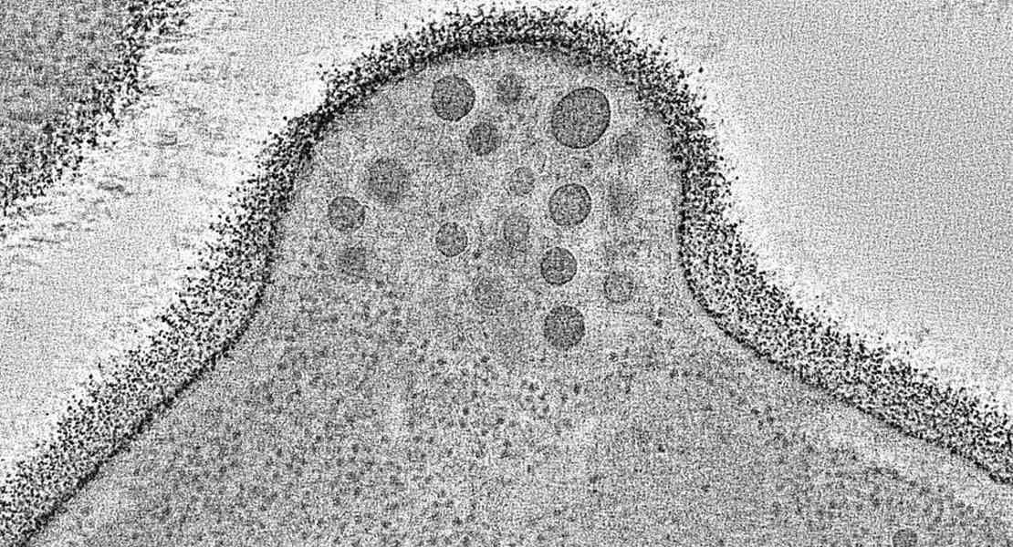 Tomografia di una cellula con più vescicole lipidiche trasportate sulla superficie cellulare.