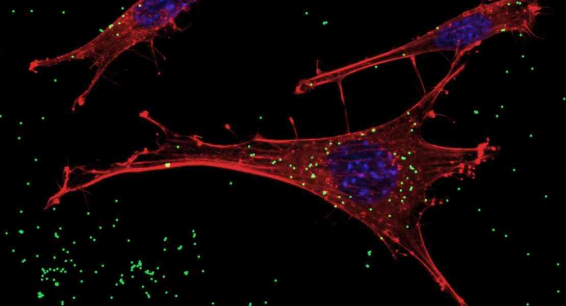  Neuroni GnRH sotto assedio dalle nanoplastiche: l’allarme per la fertilità.