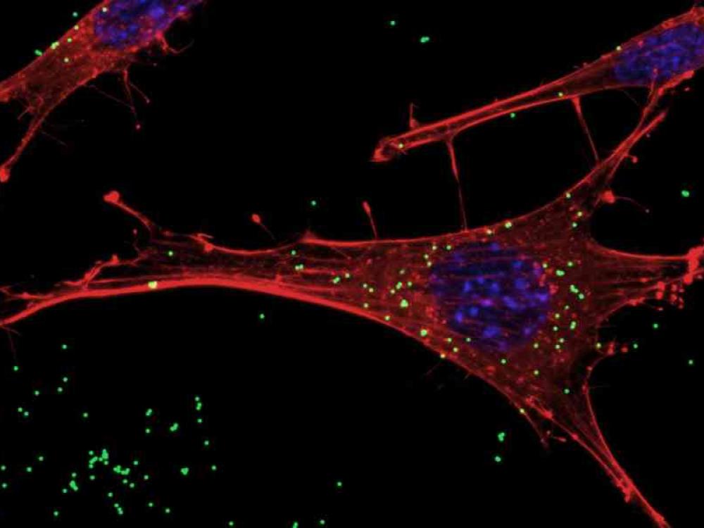  Neuroni GnRH sotto assedio dalle nanoplastiche: l’allarme per la fertilità