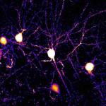 I neuroni e le loro estensioni di filiale note come dendriti sono presenti nella corteccia cerebrale di un topo.