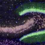 Quattro mRNA localizzati nel neuropilo, la fitta rete di connessioni sinaptiche in uno strato distinto dai corpi cellulari, nell’ippocampo giovanile del topo. Gli mRNA sono stati etichettati utilizzando il test di ibridazione in situ HiPlex RNAscope per rilevare Adcy1 (verde), Aco2 (magenta), Psd (ciano) e Dlg4 (giallo) e i nuclei sono stati controcolorati con DAPI (blu).