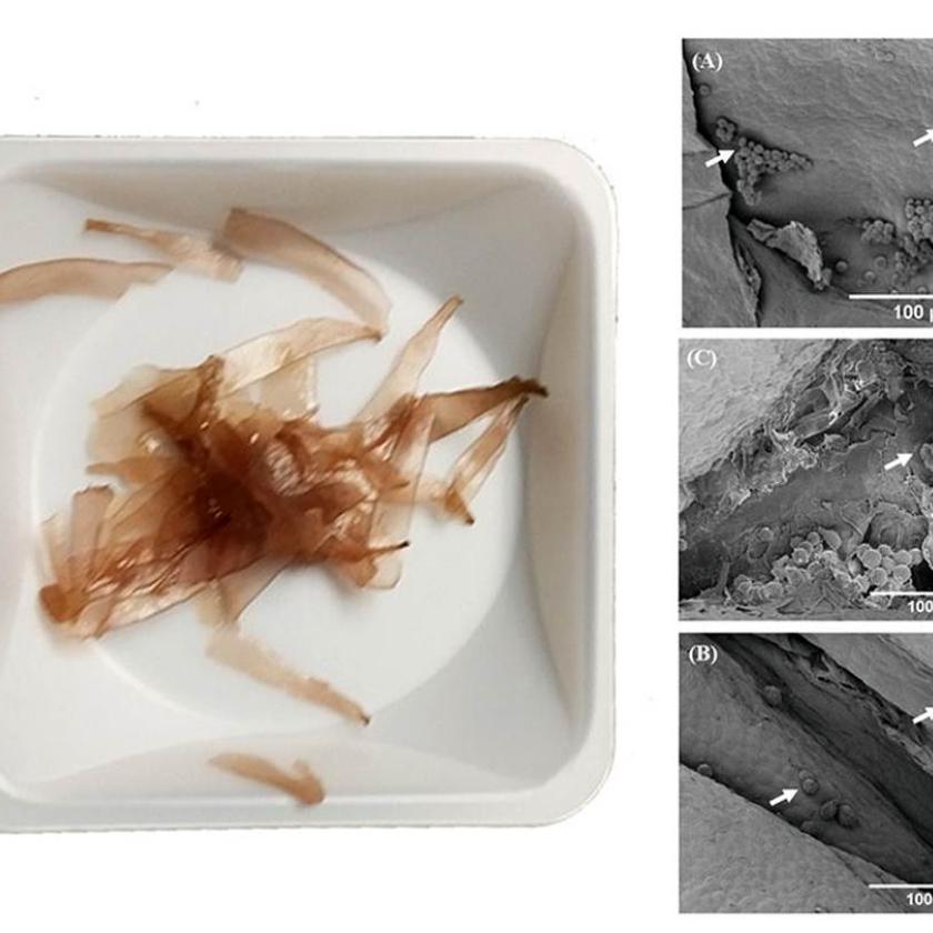 Il campione di alghe prima della preparazione e immagini SEM degli scaffold di alghe con nuove cellule.