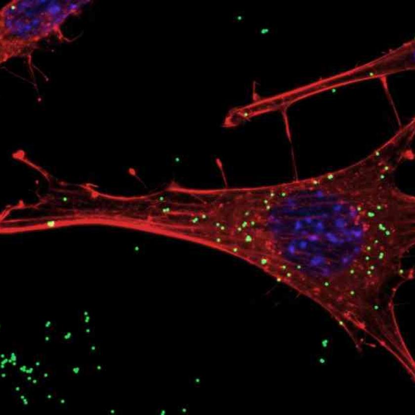  Neuroni GnRH sotto assedio dalle nanoplastiche: l’allarme per la fertilità.