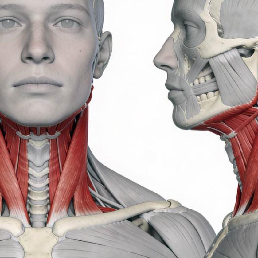 Sternocleidomastoideo